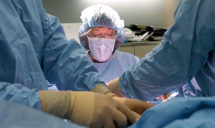 Péniszvastagság műtét